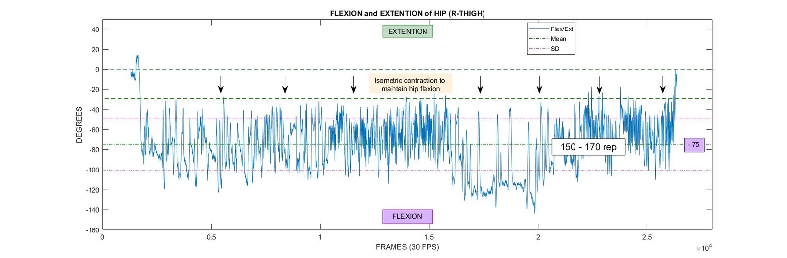 Hip Flexion/Extension Right